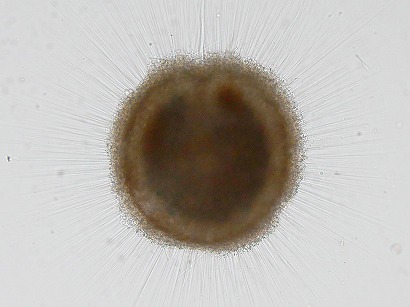 Spongodiscus biconcavus
