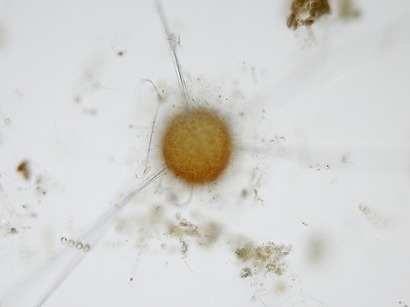 Spongosphaera streptacantha